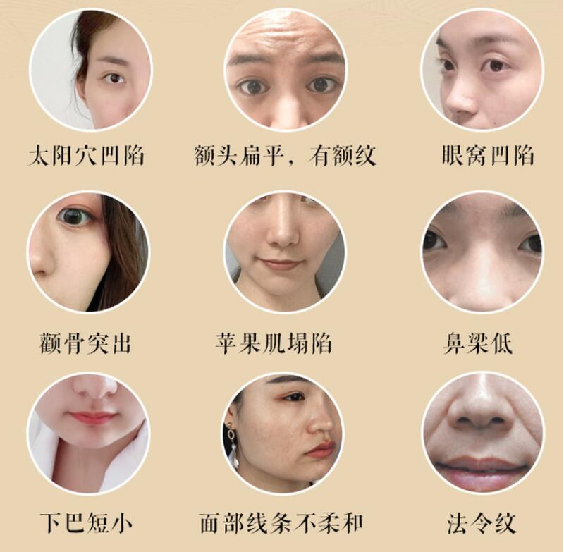 宫廷古方:12节徒手小脸塑颜术 宫廷古方:12节徒手小脸塑颜术