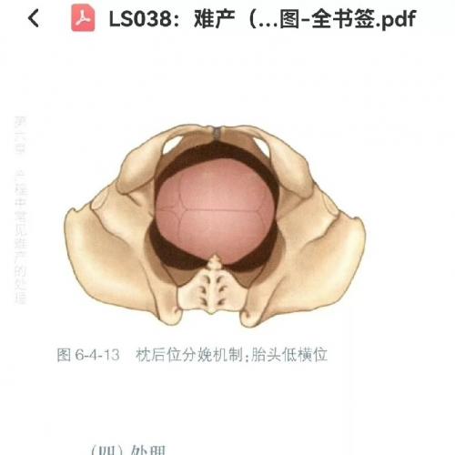 难产 第二版pdf高清 彩图 全书签 电子版电子书电子资料  带书签，实拍截图见下方图集。   本店