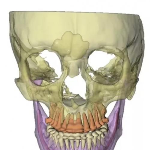 3dslicer的DentalSegmentator（DS）插件安装，可以自动分割出牙根、神经以及上